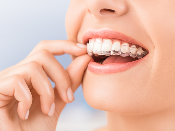 矯正歯科・小児矯正歯科